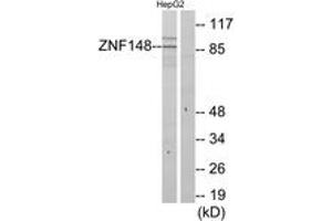 Western blot analysis of extracts from HepG2 cells, using ZNF148 Antibody. (ZNF148 antibody  (AA 61-110))