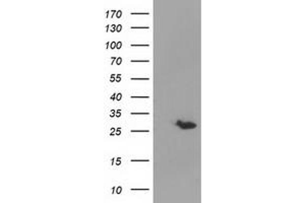 GSTT2 antibody