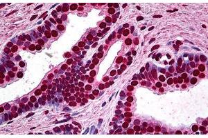Human Prostate: Formalin-Fixed, Paraffin-Embedded (FFPE) (MEF2A antibody  (AA 71-170))