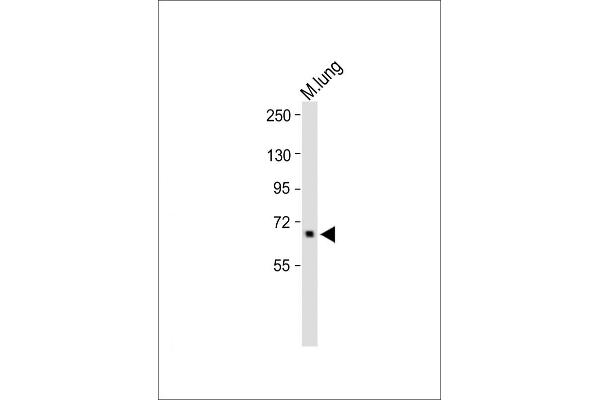 ALOX12 antibody  (C-Term)