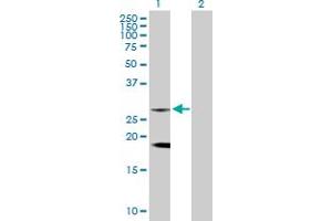 Western Blot analysis of CLTB expression in transfected 293T cell line by CLTB MaxPab rabbit polyclonal antibody. (CLTB antibody  (AA 1-211))