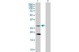 Western Blot analysis of CLTB expression in transfected 293T cell line by CLTB MaxPab rabbit polyclonal antibody.