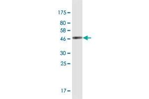 Western Blot detection against Immunogen (42 KDa) . (SPANXN3 antibody  (AA 1-141))