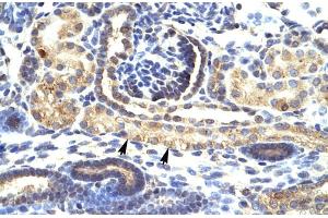 Immunohistochemistry (IHC) image for anti-SNAIL (SNAI1) (N-Term) antibody (ABIN2777858)