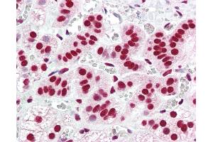 Anti-ACIN1 / Acinus antibody IHC of human adrenal.