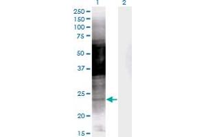 Western Blot analysis of PRKCDBP expression in transfected 293T cell line by PRKCDBP monoclonal antibody (M04), clone 8D3. (PRKCDBP antibody  (AA 161-261))