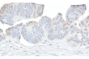 anti-Cyclin K (CCNK) (AA 530-580) antibody