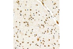 Immunohistochemistry of paraffin embedded mouse cerebellum using USP27 (ABIN7076113) at dilution of 1:700 (400x lens) (USP27X antibody)