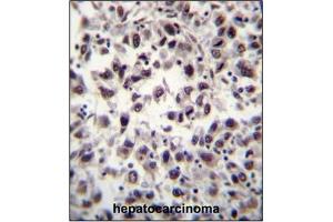 Immunohistochemistry (Paraffin-embedded Sections) (IHC (p)) image for anti-Splicing Factor, Arginine/Serine Rich 7 (SFRS7) (AA 68-98), (N-Term) antibody (ABIN954768)