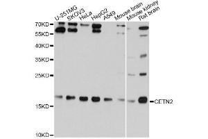 Western blot analysis of extracts of various cell lines, using CETN2 Antibody. (CETN2 antibody  (AA 1-172))