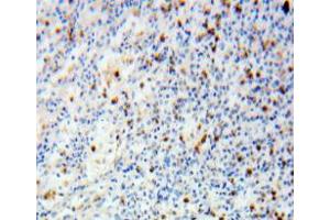 Used in DAB staining on fromalin fixed paraffin-embedded spleen tissue (Catalase antibody  (AA 246-366))