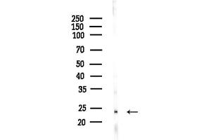anti-Claudin 6 (CLDN6) (pTyr219) antibody