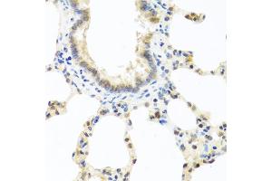 Immunohistochemistry of paraffin-embedded rat lung using DEDD antibody (ABIN5973422) at dilution of 1/100 (40x lens).
