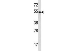 TBC1D3E antibody western blot analysis in NCI-H292 lysate (TBC1D3E (AA 498-527) antibody)