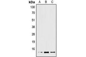 Western blot analysis of XCL2 expression in Jurkat (A), mouse liver (B), rat liver (C) whole cell lysates. (XCL2 antibody  (Center))
