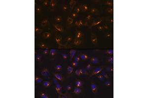 Immunofluorescence analysis of U-2 OS cells using RA Rabbit mAb (ABIN7269792) at dilution of 1:100 (40x lens). (RAB11A antibody)