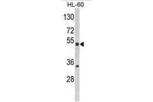 Western blot analysis of NR1I2 Antibody (Center) in HL-60 cell line lysates (35ug/lane). (NR1I2 antibody  (Middle Region))