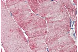 Human Skeletal Muscle: Formalin-Fixed, Paraffin-Embedded (FFPE) (Aurora A antibody)