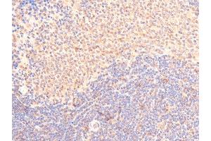 ABIN6267289 at 1/100 staining rat spleen cancer tissue sections by IHC-P. (p53 antibody  (pSer15))