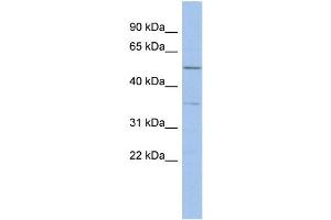 WB Suggested Anti-ABHD15 Antibody Titration: 0. (ABHD15 antibody  (Middle Region))