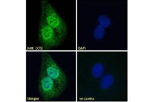 (ABIN185018) Immunofluorescence analysis of paraformaldehyde fixed U2OS cells, permeabilized with 0.