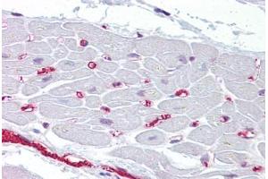 Anti-BMP10 antibody IHC staining of human heart.