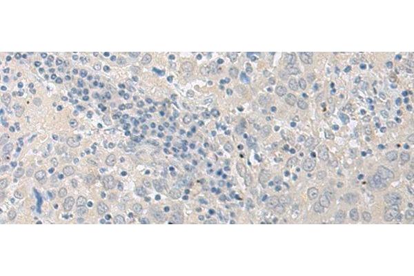 LYRM2 antibody