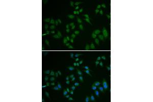 Immunofluorescence analysis of U2OS cell using TP63 antibody. (p63 antibody)