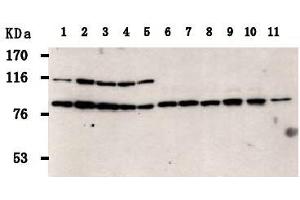 Western Blotting (WB) image for anti-PRP3 Pre-mRNA Processing Factor 3 Homolog (PRPF3) antibody (ABIN1449201) (PRPF3 antibody)