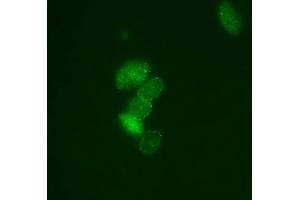 Immunofluorescence (IF) image for anti-Small Ubiquitin Related Modifier Protein 1 (SUMO1) (full length) antibody (FITC) (ABIN2452136) (SUMO1 antibody  (full length) (FITC))