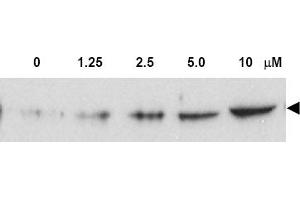 Figure. (CHEK2 antibody  (pThr68))