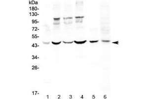 Western blot testing of human 1) HeLa, 2) MCF7, 3) HepG2, 4) A549, 5) rat spleen and 6) mouse thymus lysate with DC-SIGN antibody at 0. (DC-SIGN/CD209 antibody)