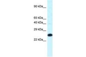 Image no. 1 for anti-Homeobox B9 (HOXB9) (C-Term) antibody (ABIN6747725) (HOXB9 antibody  (C-Term))