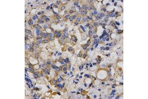 Immunohistochemistry (IHC) image for anti-Chloride Channel 5 (CLCN5) antibody (ABIN1876908) (Chloride Channel 5 antibody)