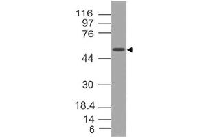 Image no. 1 for anti-SRY (Sex Determining Region Y)-Box 10 (SOX10) (AA 115-269) antibody (ABIN5027534) (SOX10 antibody  (AA 115-269))