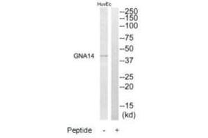 Western blot analysis of extracts from HuvEc cells, using GNA14 antibody. (GNa14 antibody  (N-Term))