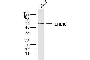 293T lysates probed with KLHL18 Polyclonal Antibody, unconjugated  at 1:300 overnight at 4°C followed by a conjugated secondary antibody for 60 minutes at 37°C. (KLHL18 antibody  (AA 451-550))