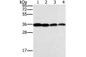 Western Blot analysis of Raji, Jurkat, 293T and hela cell using CENPV Polyclonal Antibody at dilution of 1:200 (CENPV antibody)