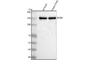 Western blot analysis of PLCB1 using anti-PLCB1 antibody (ABIN7602641).