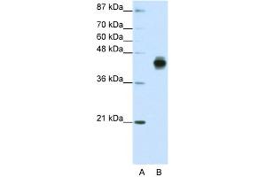 WB Suggested Anti-KRT18 Antibody Titration:  1. (Cytokeratin 18 antibody  (C-Term))