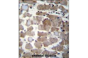 CTSK Antibody (Center E112) immunohistochemistry analysis in formalin fixed and paraffin embedded human skeletal muscle followed by peroxidase conjugation of the secondary antibody and DAB staining. (Cathepsin K antibody  (AA 97-126))