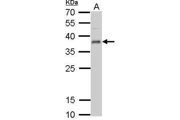 UFD1L Antikörper  (full length)