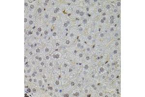 Immunohistochemistry of paraffin-embedded mouse liver using SKP2 antibody (ABIN5995995) at dilution of 1/100 (40x lens). (SKP2 antibody)