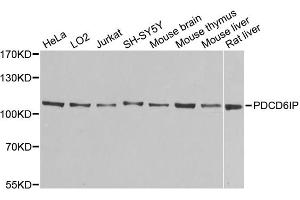 Western blot analysis of extracts of various cell lines, using PDCD6IP antibody (ABIN5971240) at 1/1000 dilution. (ALIX antibody)