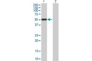 Western Blot analysis of GAL3ST4 expression in transfected 293T cell line by GAL3ST4 MaxPab polyclonal antibody. (GAL3ST4 antibody  (AA 1-486))