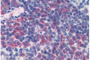 Mouse Spleen: Formalin-Fixed, Paraffin-Embedded (FFPE) (CD69 antibody  (FITC))