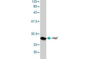 Detection of HIV-1 Nef by Western blotting using the HIV-1 Nef polyclonal antibody  . (HIV-1 Nef antibody)