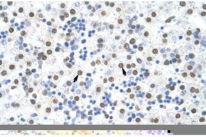 Rabbit Anti-MSI2 Antibody ,Paraffin Embedded Tissue: Human Liver  Cellular Data: Hepatocytes  Antibody Concentration: 4. (MSI2 antibody  (N-Term))