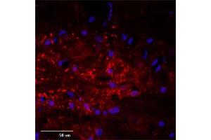 IF (confocal) on rat brain at a concentration of 30 µg/ml using Rabbit antibody to rat, mouse Mtap2 (Microtubule-associated protein 2, MAP-2, MAP 2, MAP2, MAP2R): IgG (ABIN350476), DAPI counterstained appearing in blue. (MAP2 antibody  (AA 350-400))