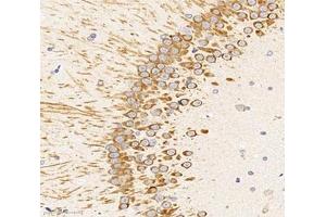 Immunohistochemistry analysis of paraffin-embedded rat hippocampus using,UNC5C (ABIN7076148) at dilution of 1: 2000 (Unc5c antibody)